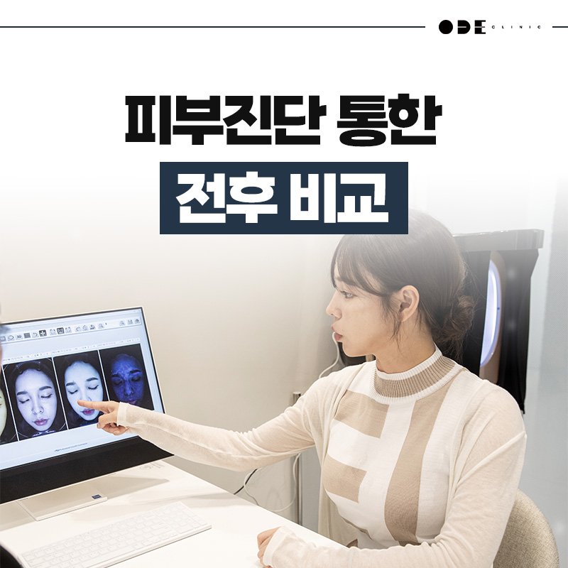 강남피부과공장형아닌곳