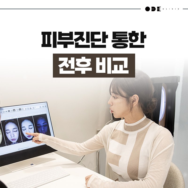 강남리프팅자연스럽게잘하는곳